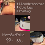 MicroSkinPolish actie: