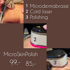 MicroSkinPolish actie: